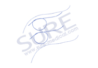 SR8135 Endotracheal Tube Introducer 